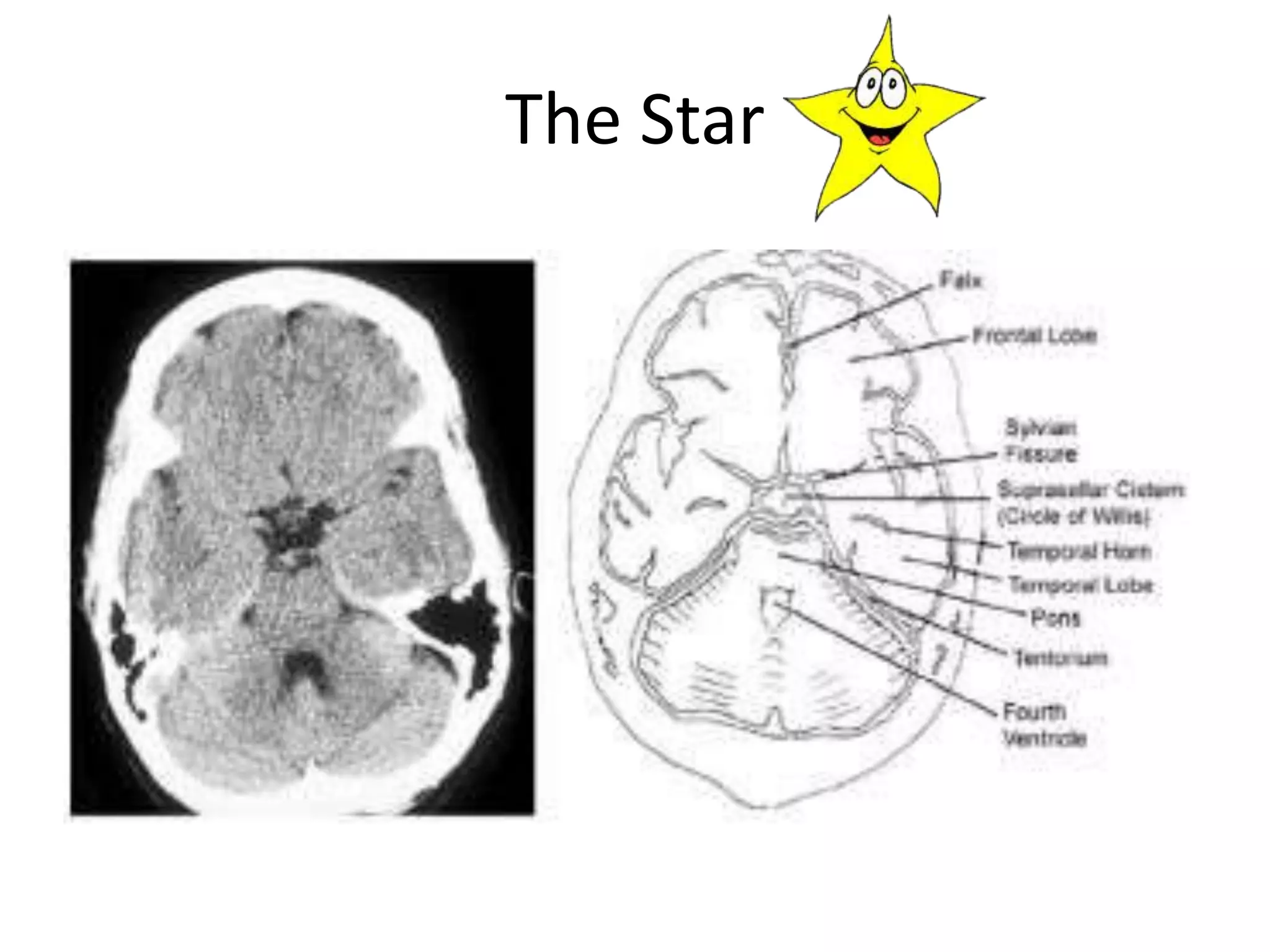 The Star