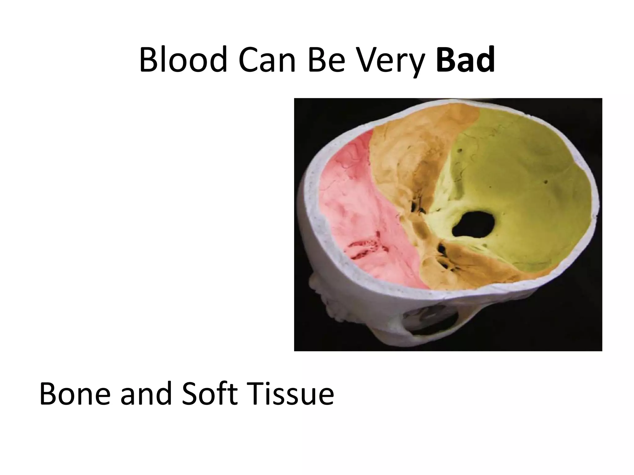 Blood Can Be Very BadBone and Soft Tissue