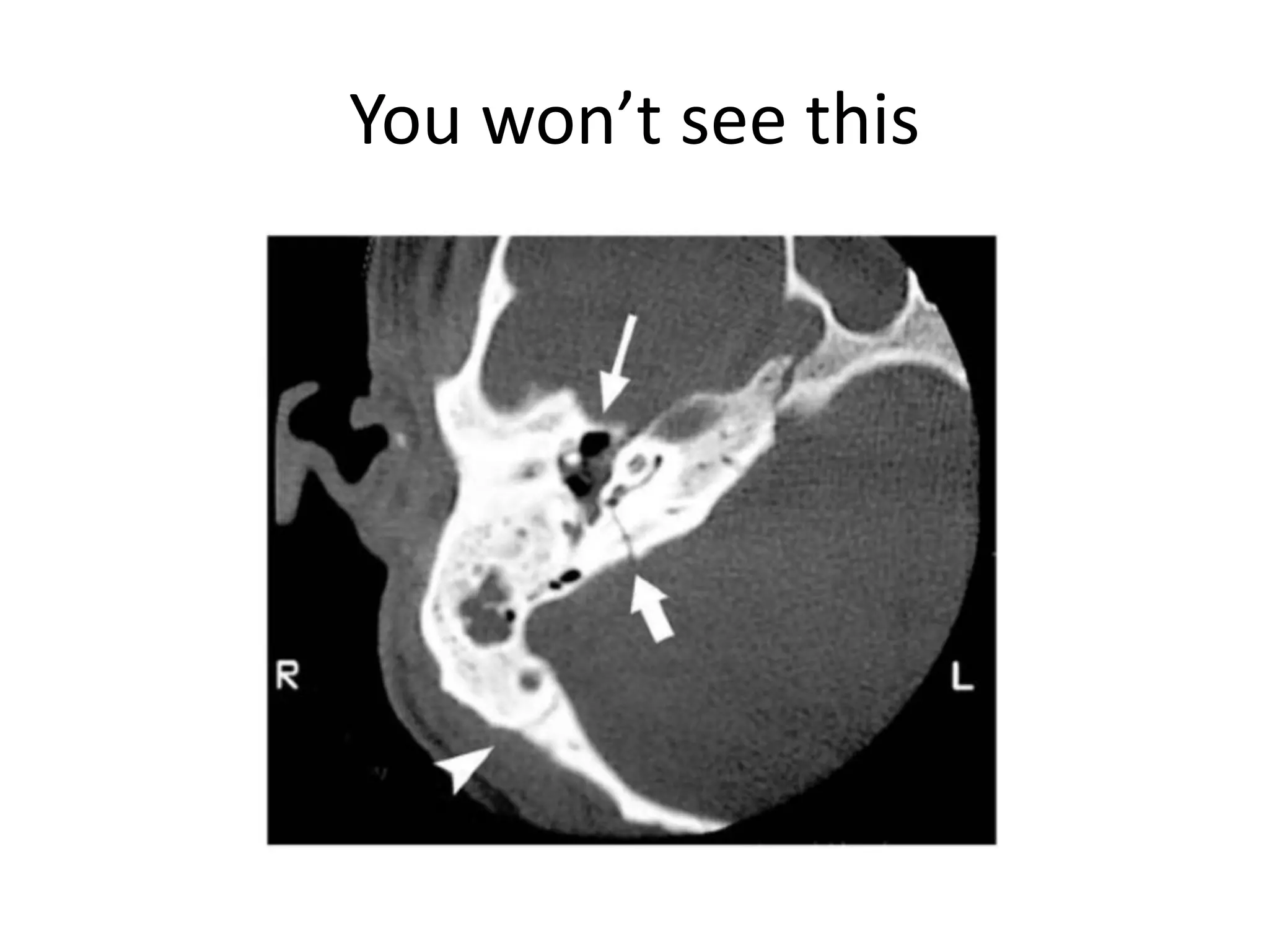 You won’t see this