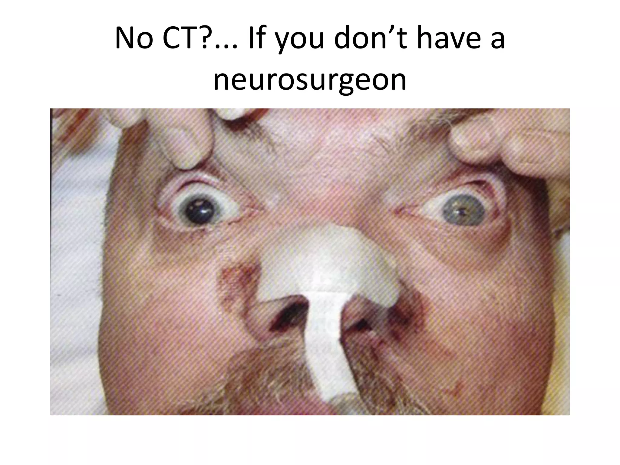 No CT?... If you don’t have a neurosurgeon