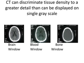 Head ct | PPTX