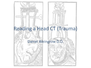 Reading a Head CT (Trauma) Daniel Weingrow D.O. 