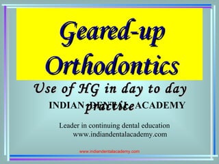 Geared-upGeared-up
OrthodonticsOrthodontics
Use of HG in day to dayUse of HG in day to day
practicepracticeINDIAN DENTAL ACADEMY
Leader in continuing dental education
www.indiandentalacademy.com
www.indiandentalacademy.com
 