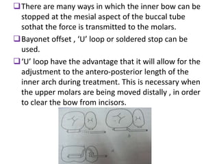 There are many ways in which the inner bow can be
stopped at the mesial aspect of the buccal tube
sothat the force is transmitted to the molars.
Bayonet offset , ‘U’ loop or soldered stop can be
used.
‘U’ loop have the advantage that it will allow for the
adjustment to the antero-posterior length of the
inner arch during treatment. This is necessary when
the upper molars are being moved distally , in order
to clear the bow from incisors.
 