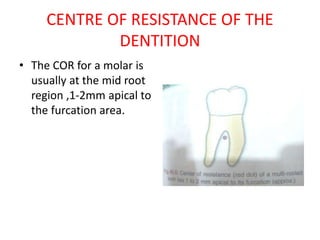 CENTRE OF RESISTANCE OF THE
DENTITION
• The COR for a molar is
usually at the mid root
region ,1-2mm apical to
the furcation area.
 