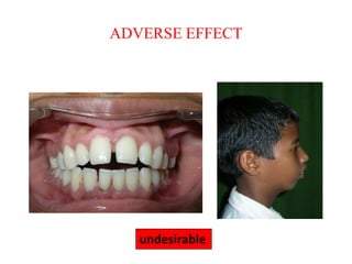 ADVERSE EFFECT
undesirable
 