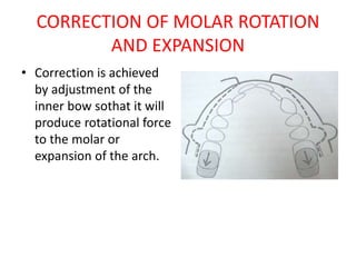 CORRECTION OF MOLAR ROTATION
AND EXPANSION
• Correction is achieved
by adjustment of the
inner bow sothat it will
produce rotational force
to the molar or
expansion of the arch.
 