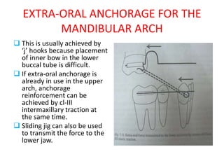 EXTRA-ORAL ANCHORAGE FOR THE
MANDIBULAR ARCH
 This is usually achieved by
‘j’ hooks because placement
of inner bow in the lower
buccal tube is difficult.
 If extra-oral anchorage is
already in use in the upper
arch, anchorage
reinforcement can be
achieved by cl-III
intermaxillary traction at
the same time.
 Sliding jig can also be used
to transmit the force to the
lower jaw.
 