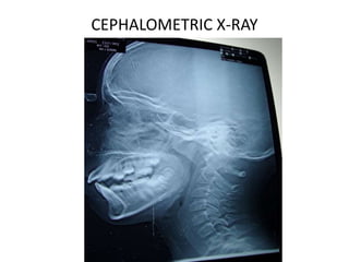 CEPHALOMETRIC X-RAY
 