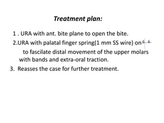 Treatment plan:
1 . URA with ant. bite plane to open the bite.
2.URA with palatal finger spring(1 mm SS wire) on
to fascilate distal movement of the upper molars
with bands and extra-oral traction.
3. Reasses the case for further treatment.
6 6
 