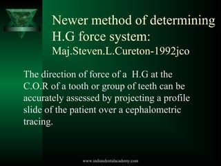 Newer method of determining
H.G force system:
Maj.Steven.L.Cureton-1992jco
The direction of force of a H.G at the
C.O.R of...