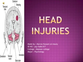 Head Injuries Made by : Marwa Hussam al-mauly ID NO : psy-fa06-017 College : Mazoon college Major : Psychology  