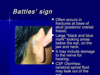 Head injuries | PPT