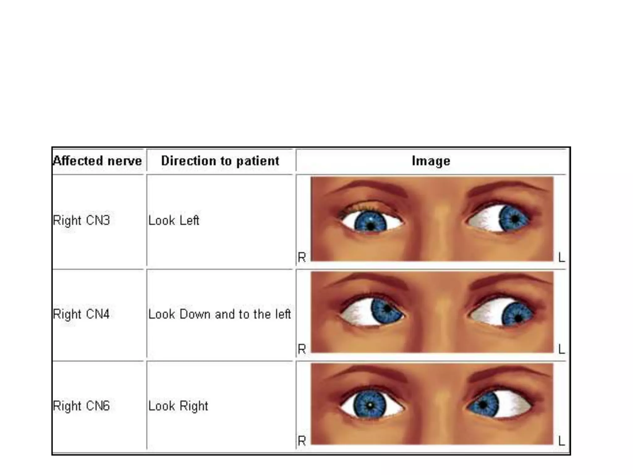 54
Cranial nerve 3,4,6:
- light reflex
- intorsion and extorsion
 