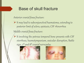 Base of skull fracture
Anterior cranial fossa fracture:
 It may lead to subconjunctival haematoma, extending to
posterior limit of sclera, epistaxis, CSF rhinorrhea
Middle cranial fossa fracture:
 It involving the petrous temporal bone presents with CSF
otorrhoea, haemotympanium, ossicular disruption, Battle
sign, 7th and 8th cranial nervepalsy.
 