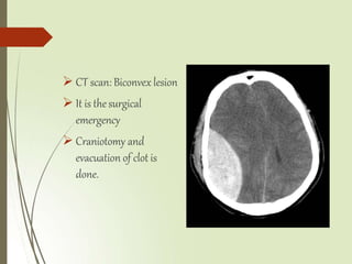  CT scan: Biconvex lesion
 It is thesurgical
emergency
 Craniotomy and
evacuation of clot is
done.
 