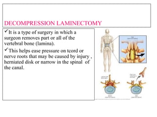headinjuries and spinal cord injury last.pptx