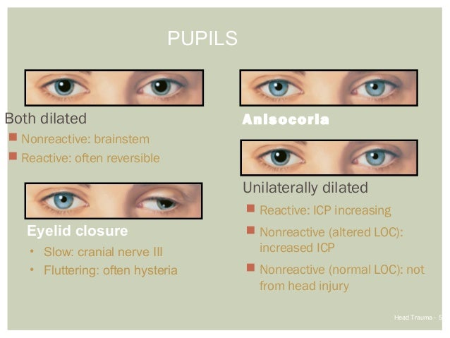 cranial nerves for pupil measurement cranial nerves for pupil measurement
