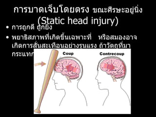 การบาดเจ็บโดยตรง  ขณะศีรษะอยู่นิ่ง   (Static head injury) การถูกตี ถูกยิง  พยาธิสภาพที่เกิดขึ้นเฉพาะที่  หรือสมองอาจเกิดการสั่นสะเทือนอย่างรุนแรง ถ้าวัตถุที่มากระแทกมีความเร็วสูง 