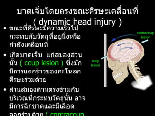 บาดเจ็บโดยตรงขณะศีรษะเคลื่อนที่   (  dynamic head injury ) ขณะที่ศีรษะมีความเร็วไปกระทบกับวัตถุที่อยู่นิ่งหรือกำลังเคลื่อนที่  เกิดบาดเจ็บ  แก่สมองส่วนนั้น  (  coup lesion )   ซึ่งมักมีการแตกร้าวของกะโหลกศีรษะร่วมด้วย  ส่วนสมองด้านตรงข้ามกับบริเวณที่กระทบวัตถุนั้น อาจมีการฉีกขาดและมีเลือดออกร่วมด้วย   ( contracoup lesion) coup lesion contracoup  lesion 