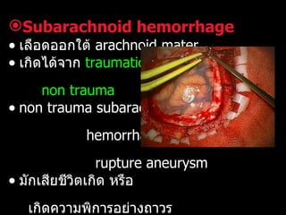 Subarachnoid hemorrhage เลือดออกใต้  arachnoid mater  เกิดได้จาก  traumatic  และ  non trauma   non trauma  subarachnoid  hemorrhages  มักเกิดจาก  rupture  aneurysm  มักเสียชีวิตเกิด หรือ  เกิดความพิการอย่างถาวร 