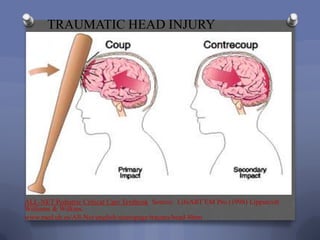 TRAUMATIC HEAD INJURY




ALL-NET Pediatric Critical Care Textbook Source: LifeART EM Pro (1998) Lippincott
Williams & Wilkins.
www.med.ub.es/All-Net/english/neuropage/trauma/head-8htm
 