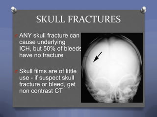 SKULL FRACTURES
O ANY skull fracture can
  cause underlying
  ICH, but 50% of bleeds
  have no fracture
                                    QuickTime™ and a




O Skull films are of little
                                      decompressor
                              are neede d to see this picture.




  use - if suspect skull
  fracture or bleed, get
  non contrast CT
 