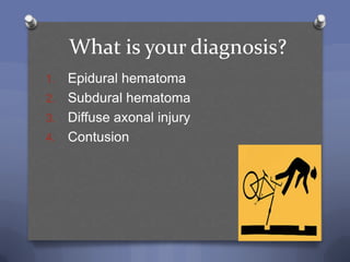 What is your diagnosis?
1. Epidural hematoma
2. Subdural hematoma
3. Diffuse axonal injury
4. Contusion
 