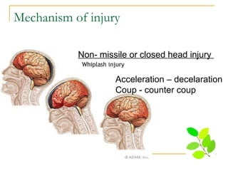 Head injury