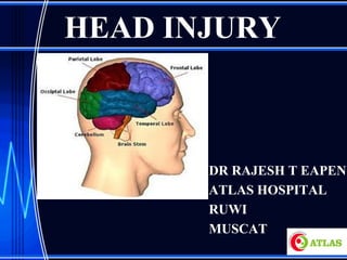 HEAD INJURY
DR RAJESH T EAPEN
ATLAS HOSPITAL
RUWI
MUSCAT
 