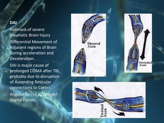 Head Injury | PPT