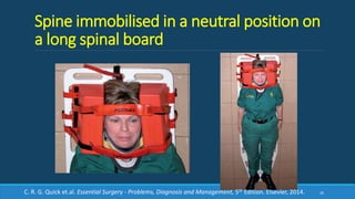 Spine immobilised in a neutral position on
a long spinal board
26C. R. G. Quick et.al. Essential Surgery - Problems, Diagnosis and Management, 5th Edition. Elsevier, 2014.
 