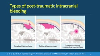 Types of post-traumatic intracranial
bleeding
51C. R. G. Quick et.al. Essential Surgery - Problems, Diagnosis and Management, 5th Edition. Elsevier, 2014.
 