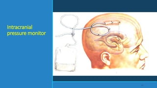 Intracranial
pressure monitor
67
 