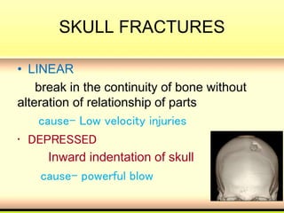 Skull Potential Injuries headinjury-170420163927.pdf