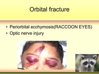 Orbital fracture
• Periorbital ecchymosis(RACCOON EYES)
• Optic nerve injury
 