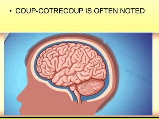 • COUP-COTRECOUP IS OFTEN NOTED
 
