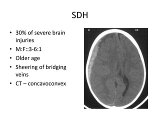 SDH
• 30% of severe brain
injuries
• M:F::3-6:1
• Older age
• Sheering of bridging
veins
• CT – concavoconvex
 