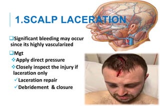 1.SCALP LACERATION
Significant bleeding may occur
since its highly vascularized
Mgt
Apply direct pressure
Closely inspect the injury if
laceration only
Laceration repair
Debridement & closure
 