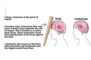 Coup--contusion at the point of
impact
Counter coup--Contusions also may
occur in brain tissue opposite the site
of impact. This is known as a contre-
coup injury. These contusions result
from deceleration of the brain against
the skull.
Contusion also occurs as the brain
slides forwards and backwards over
the ridged cranial fossa floor
 