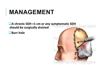 MANAGEMENT
A chronic SDH >1 cm or any symptomatic SDH
should be surgically drained
Burr hole
 