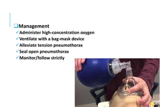Management
Administer high-concentration oxygen
Ventilate with a bag-mask device
Alleviate tension pneumothorax
Seal open pneumothorax
Monitor/follow strictly
 
