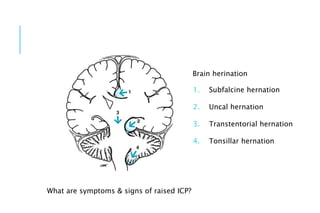 1. Subfalcine hernation
2. Uncal hernation
3. Transtentorial hernation
4. Tonsillar hernation
What are symptoms & signs of raised ICP?
Brain herination
 
