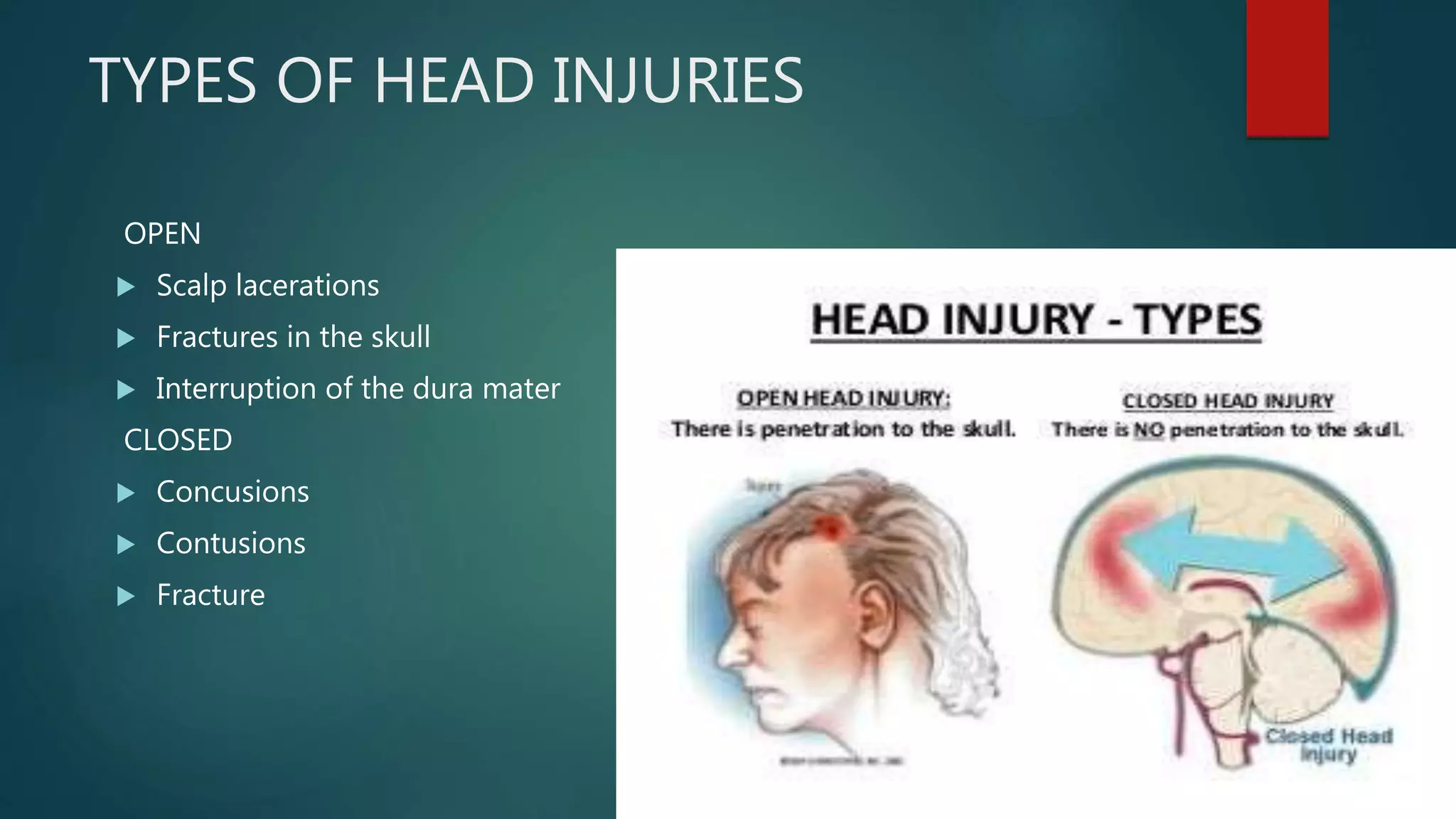 HEAD INJURY.pptx