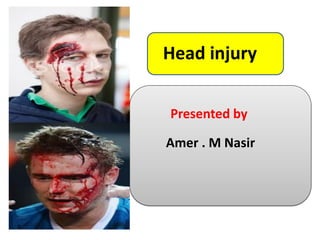 Head injury
Presented by
Amer . M Nasir
 
