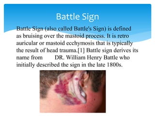 head injury accidental injury RTA .pptx