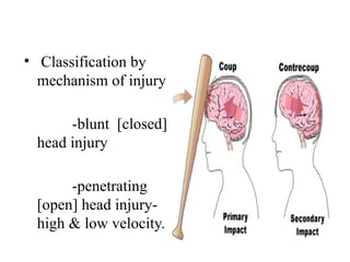 • Classification by
mechanism of injury
-blunt [closed]
head injury
-penetrating
[open] head injury-
high & low velocity.
 