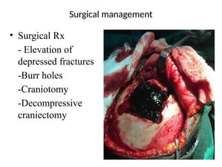 Surgical management
• Surgical Rx
- Elevation of
depressed fractures
-Burr holes
-Craniotomy
-Decompressive
craniectomy
 