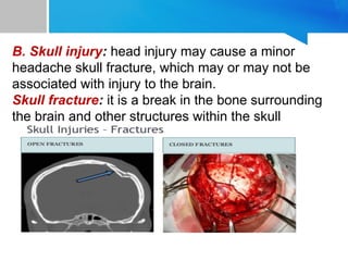 Skull Potential Injuries headinjuryguigiuguigiugiugiuguigiuguig.pptx
