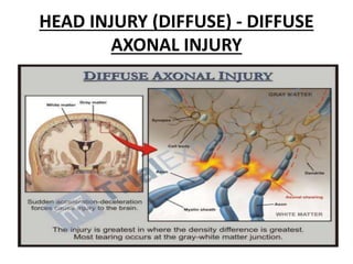 HEAD INJURY (DIFFUSE) - DIFFUSE
AXONAL INJURY
 